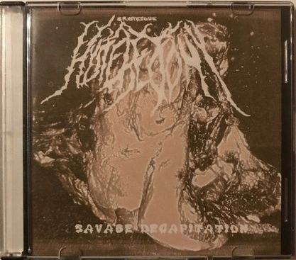 Grotesque Hysterectomy : Savage Decapitation